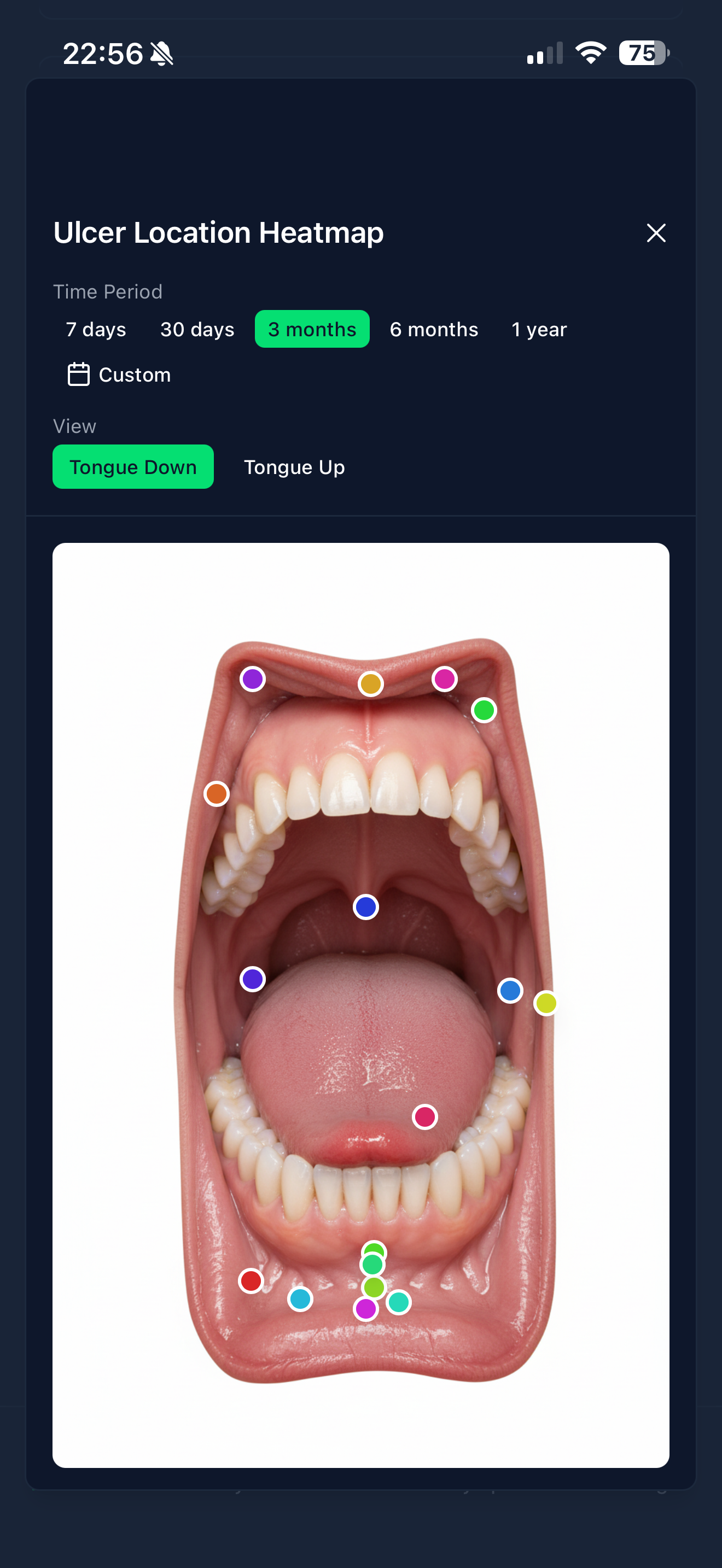 App Mouth Map Mockup